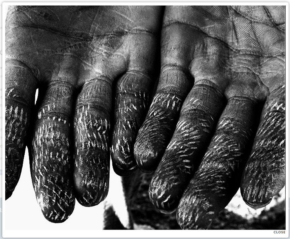 Migration and Self-Mutilation as Protest